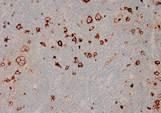 CD15 （MMA）